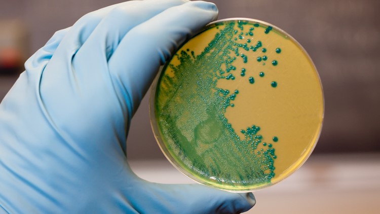 CDC investigates Listeria outbreak possibly linked to Florida