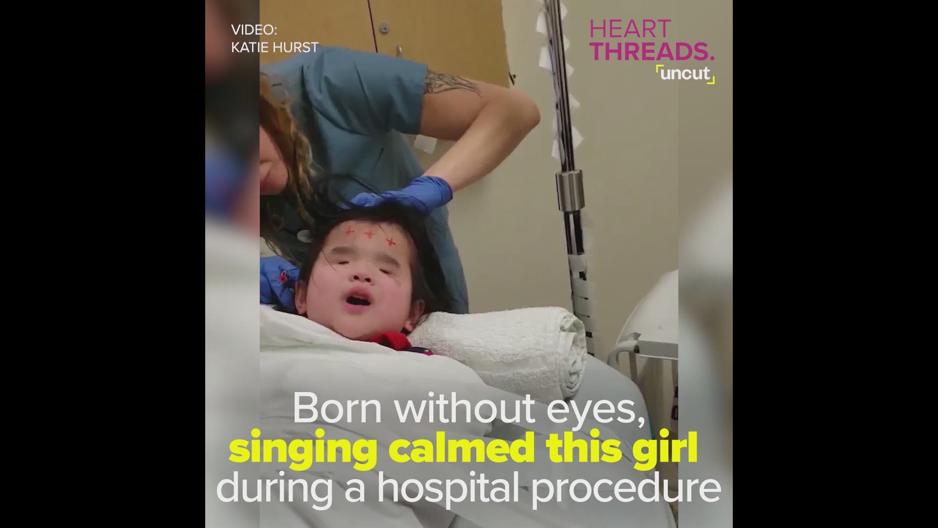 Evie, who was born without eyes, gets very scared at the doctor's. So when she had a panic attack, a music therapist helped her calm down by singing Alessia Cara's "Scars to Your Beautiful."