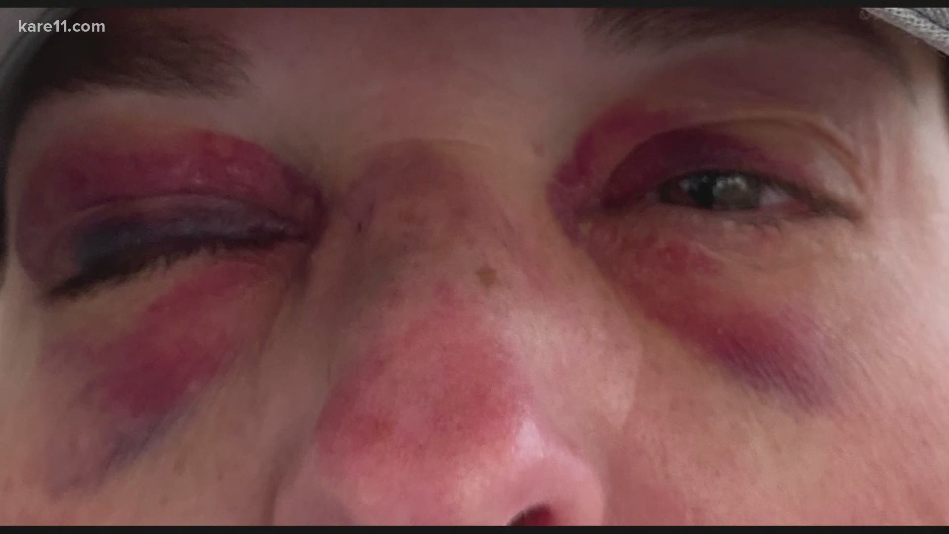 Couple says they were assaulted by a large group of people Friday night