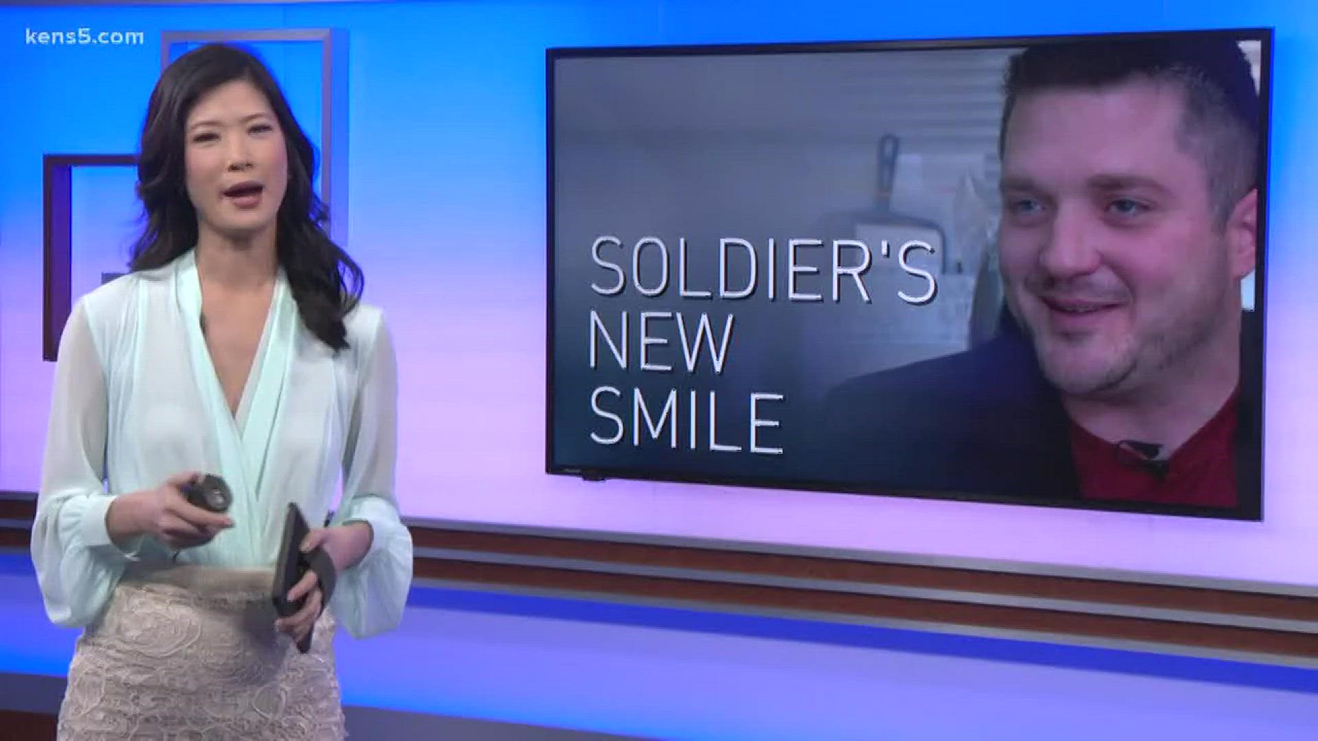 Sgt. James Weinhold got his smile back thanks to a nonprofit organization and a San Antonio dentist's office that did the treatment for free.