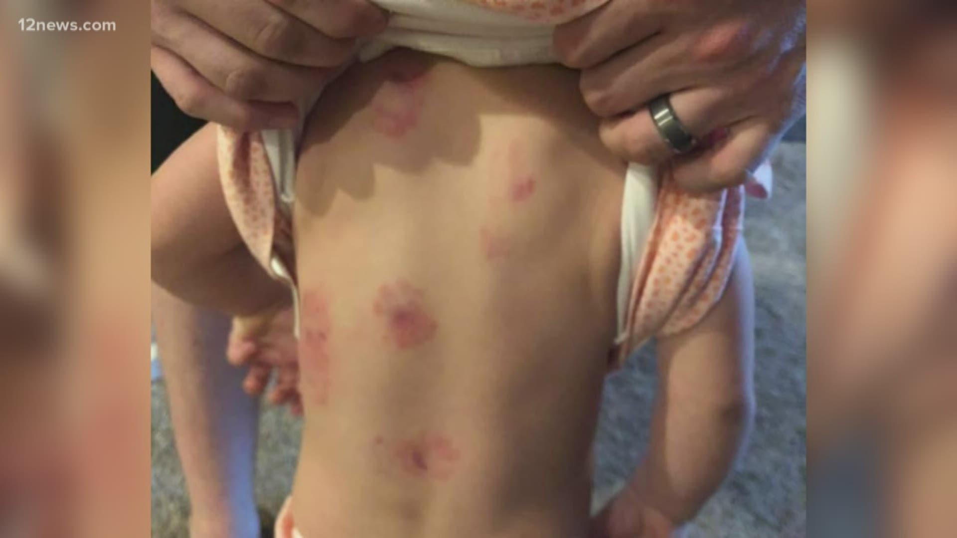 Maricopa parents want answers after their daughter was bitten 8 times at a daycare. The parents said a teacher told them their daughter was bitten, but it wasn't until later the parents found out how many times she was bitten.