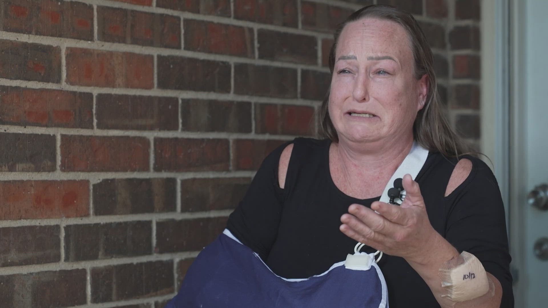 North Texas woman recovering after violent dog attack at park | wtsp.com