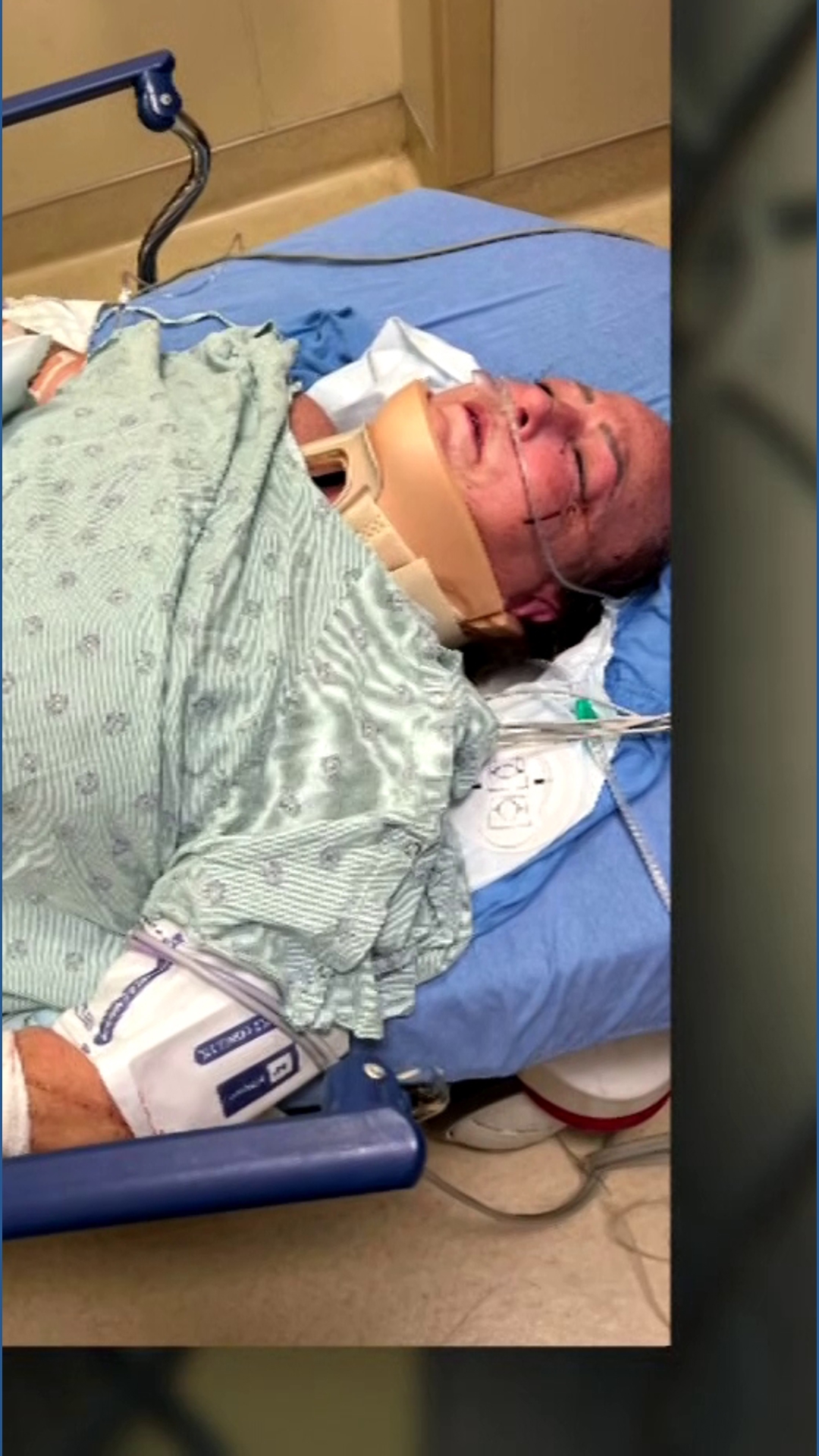 North Texas woman recovering after violent dog attack at park | wtsp.com