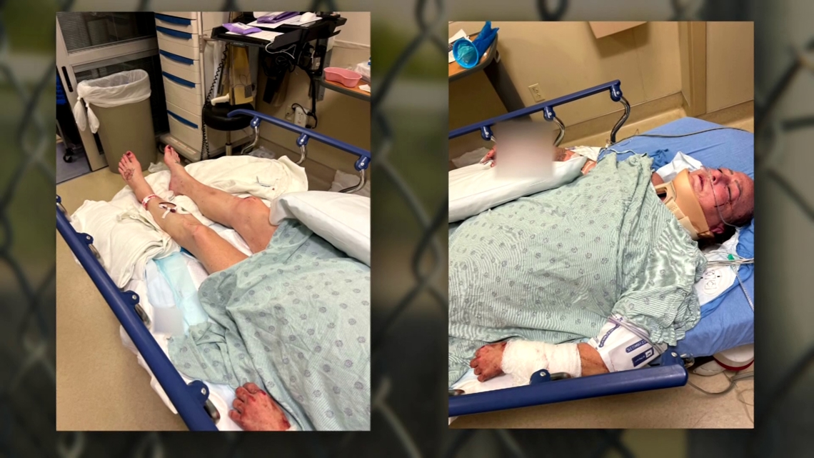 North Texas woman recovering after violent dog attack at park | wtsp.com