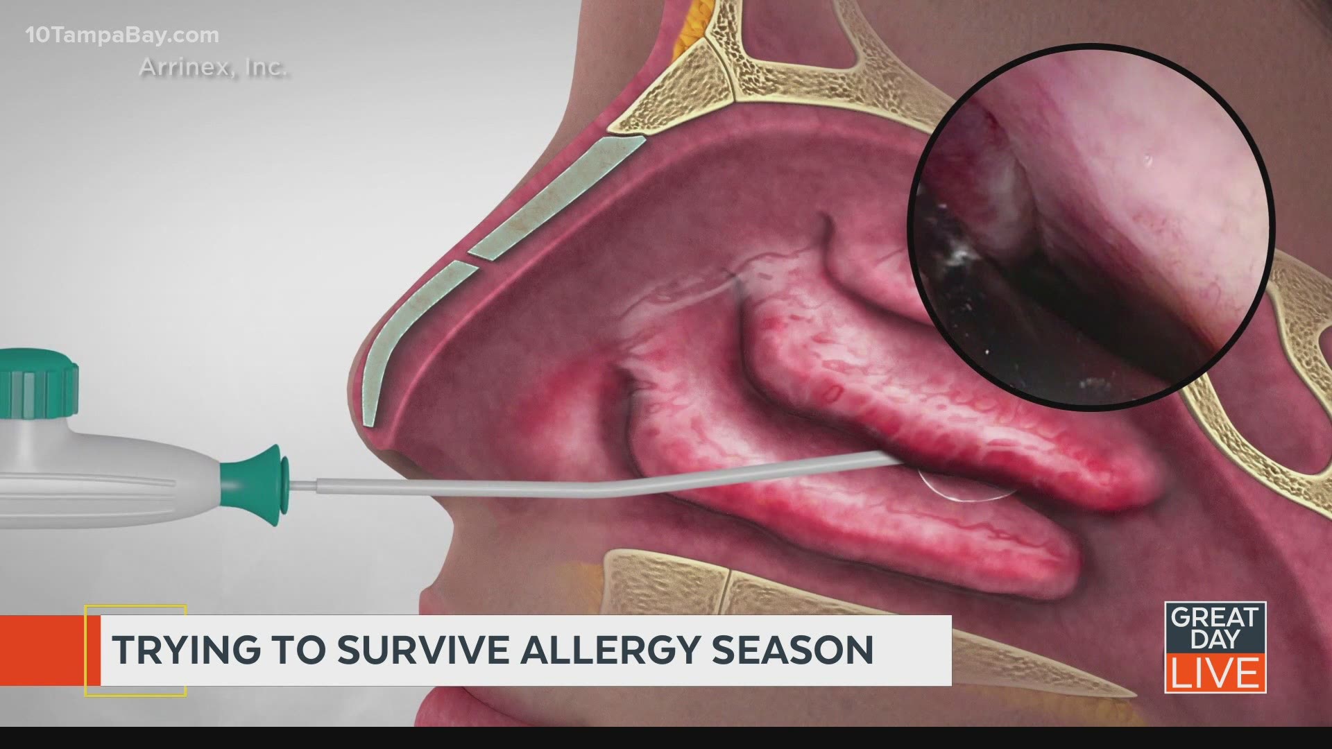 Surviving allergy season in Tampa Bay