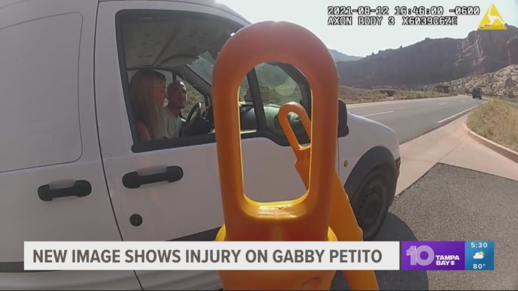 New images show injury on Gabby Petito after police stopped them in Moab