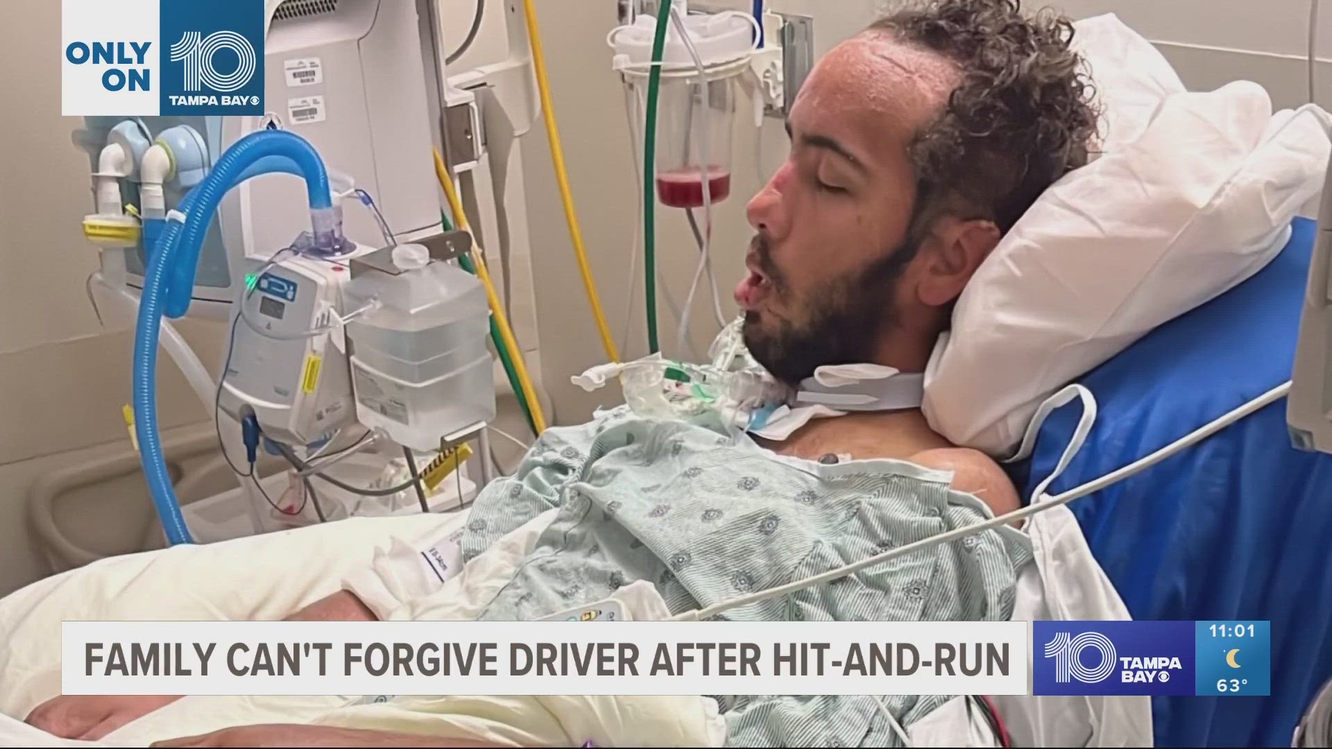 The hit-and-run happened near State Road 544 in Winter Haven while he was riding home on his electric scooter.