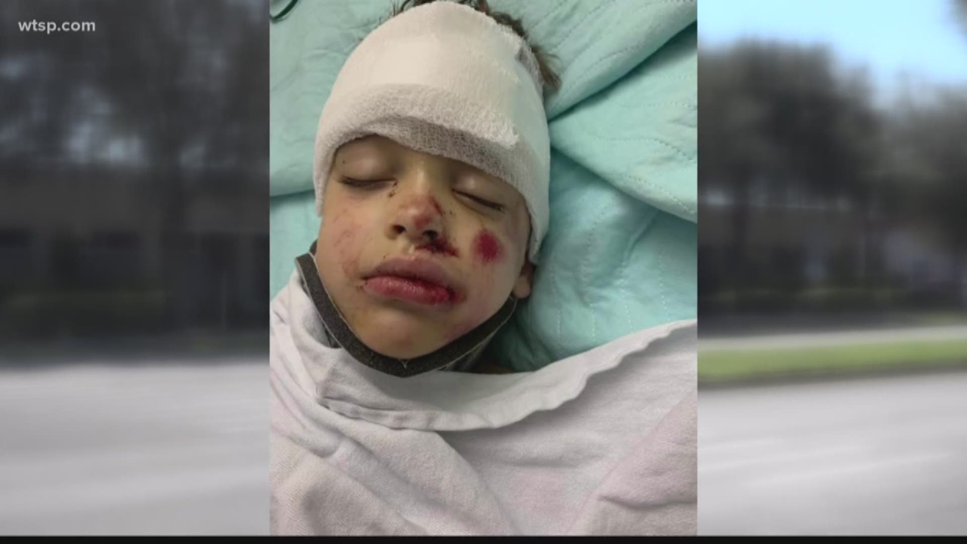 When a little boy was hit by a car trick-or-treating, a local business owner jumped to help. Now, he's raising money for change. https://bit.ly/2N8uHCY