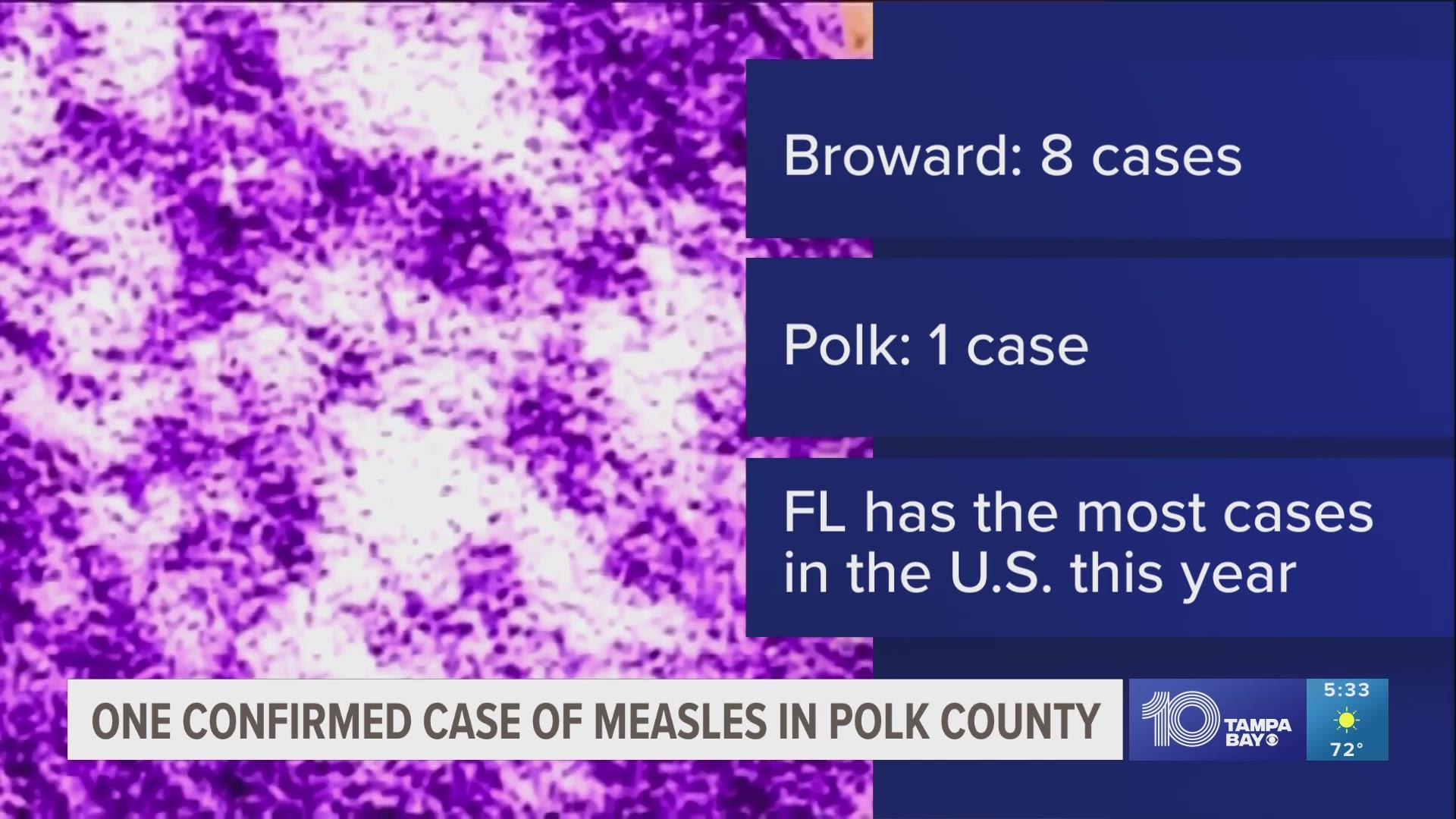 As of Feb. 25, there have been 9 reported measles cases throughout the state — 8 in Broward County and 1 in Polk County.