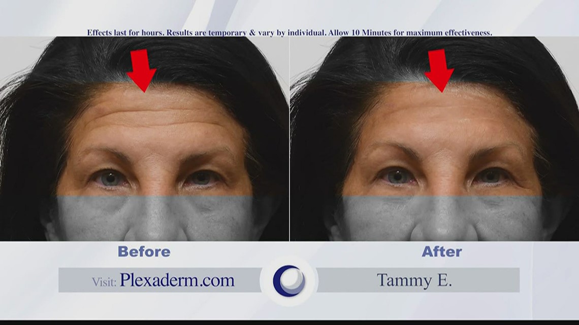 Take years off your face in just 10 minutes really!
