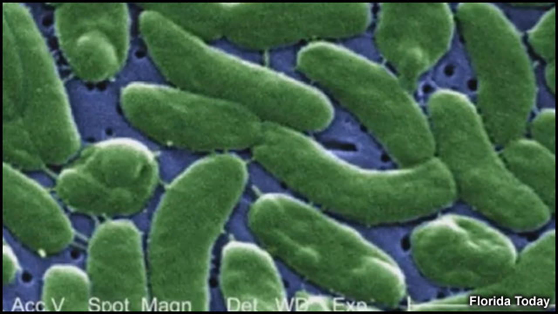 Flesheating bacteria cases confirmed in Gulf of Mexico