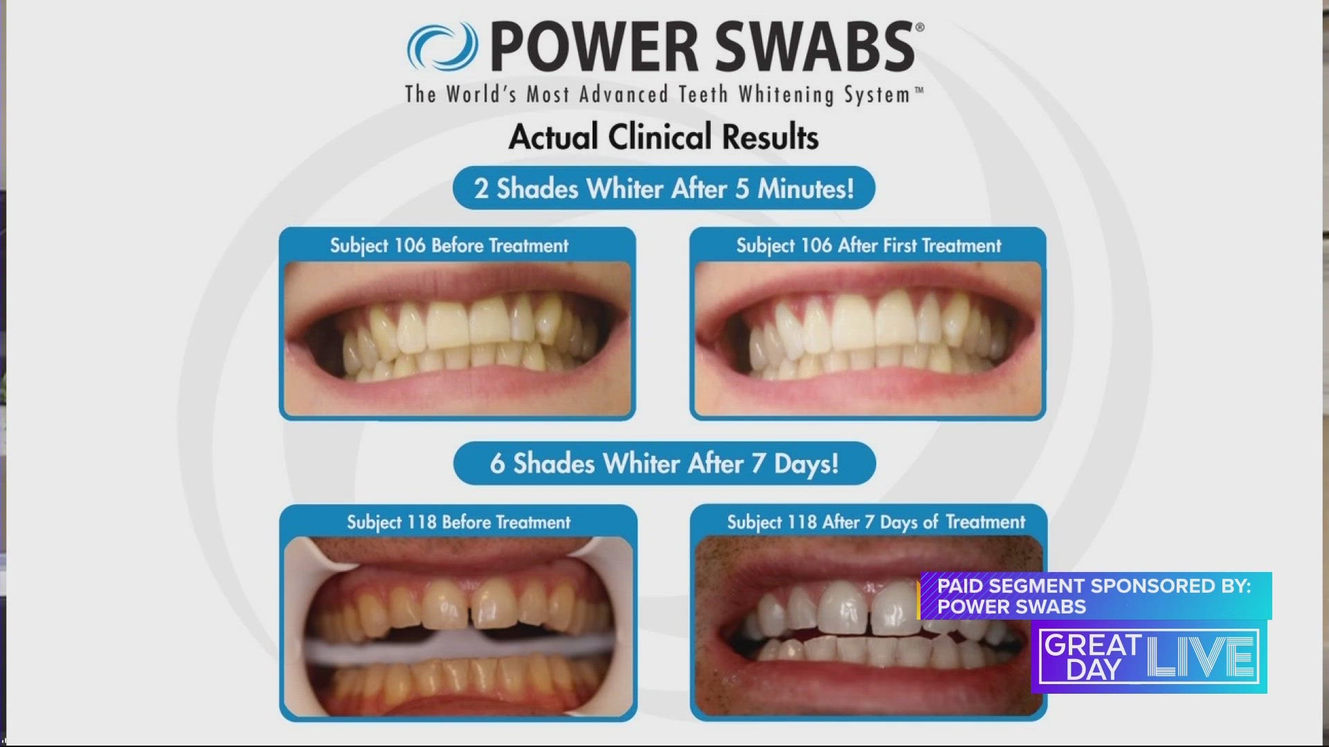 Power Swabs can whiten your teeth without painful sensitivity and right from your home. Get this Memorial day special with 50% off if you call 800-934-7642.