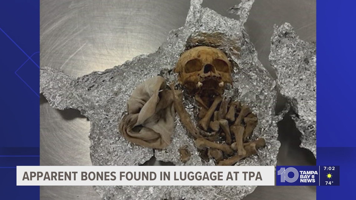 Apparent human remains, including 'part of a skull,' found in