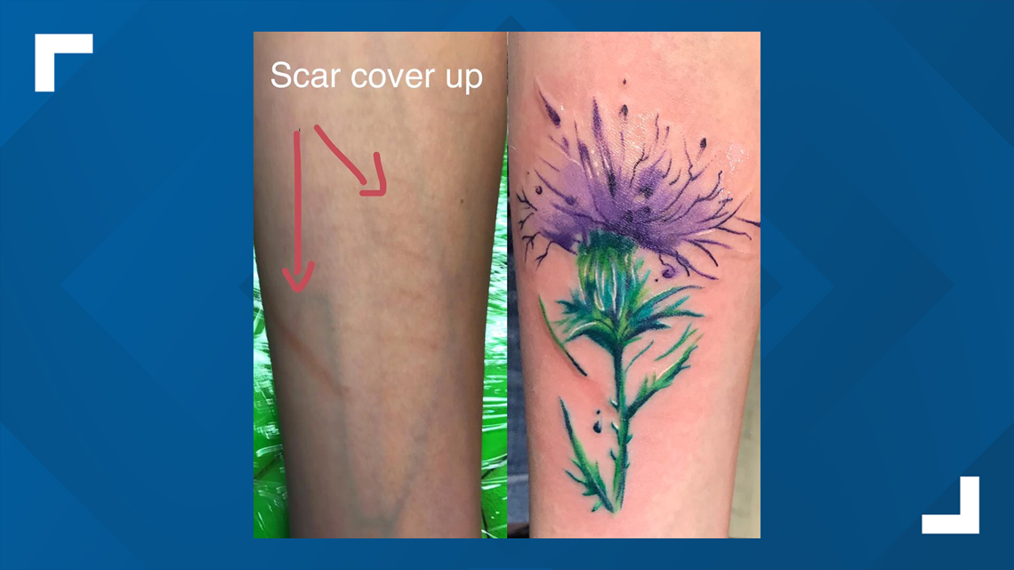 JO BLOGS My clients story Morags scar coverup tattoo  UN1TY Tattoo  Studio  Shrewsbury