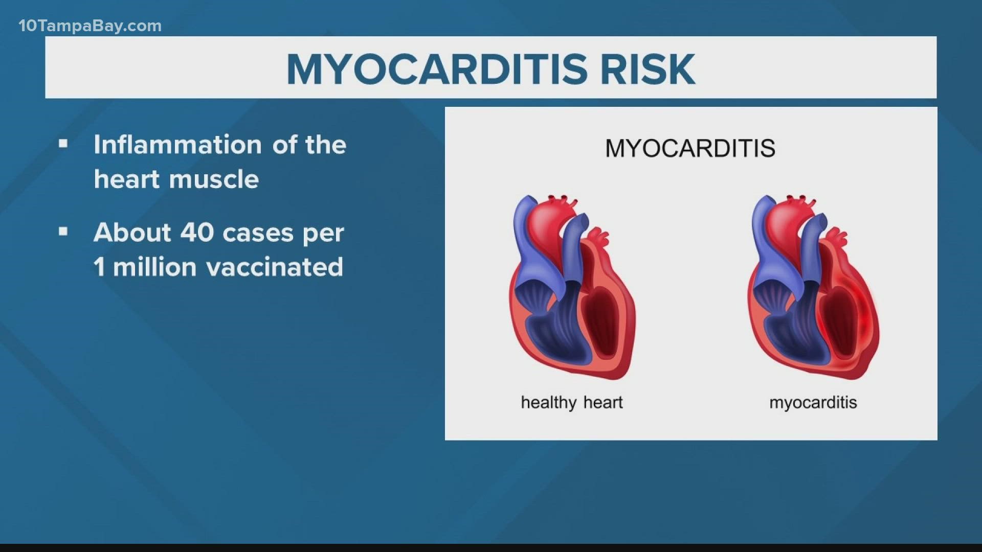 Ahead of Pfizer filing for Emergency Use Authorization for more kids to get the COVID-19 vaccine, a pediatric cardiologist talks about the risks.