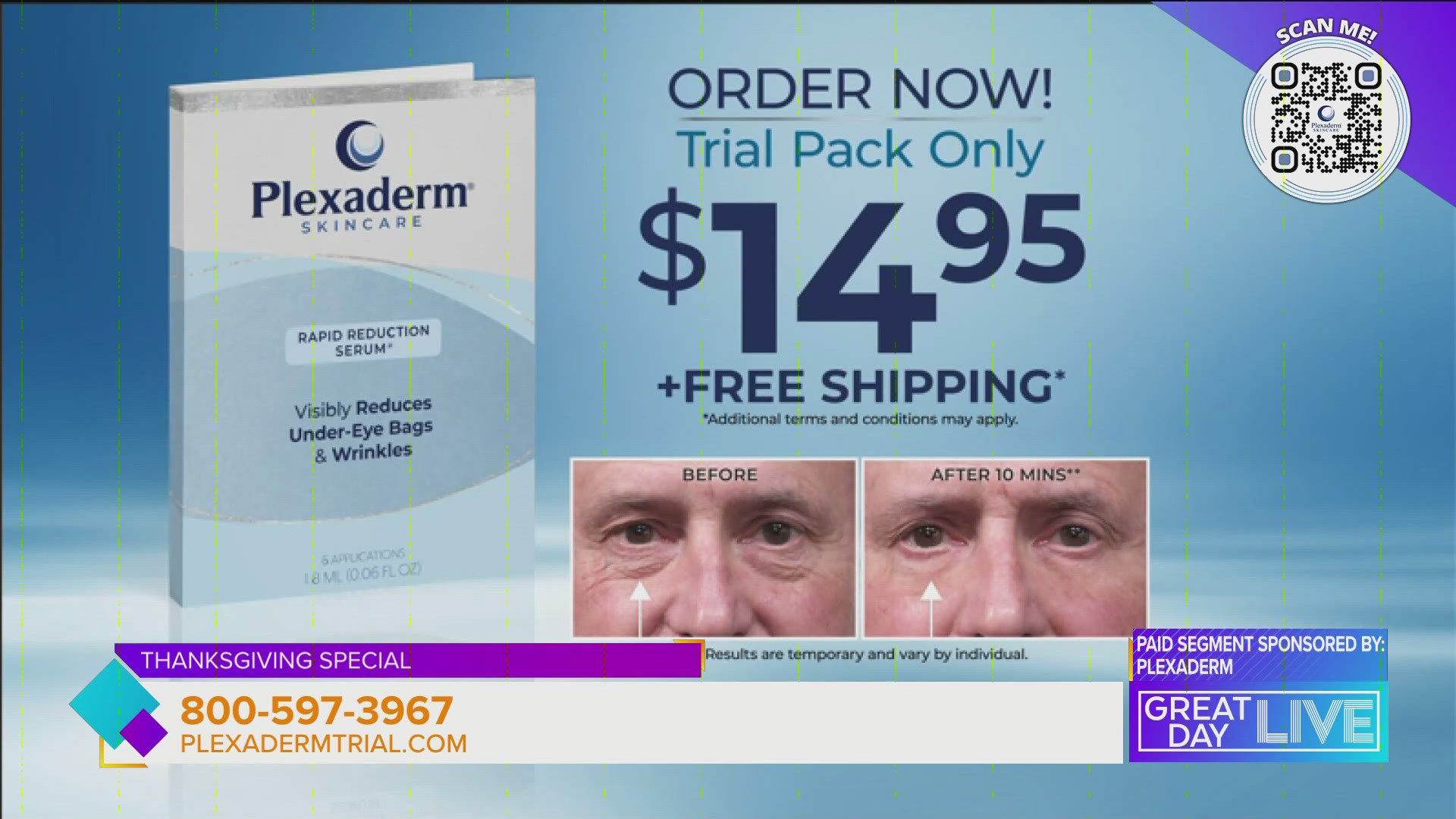 Paid segment sponsored by Plexaderm. During this Thanksgiving special you will get to try Plexaderm for $14.95 plus free shipping. Head to https://plxa.de/3lUdEW5