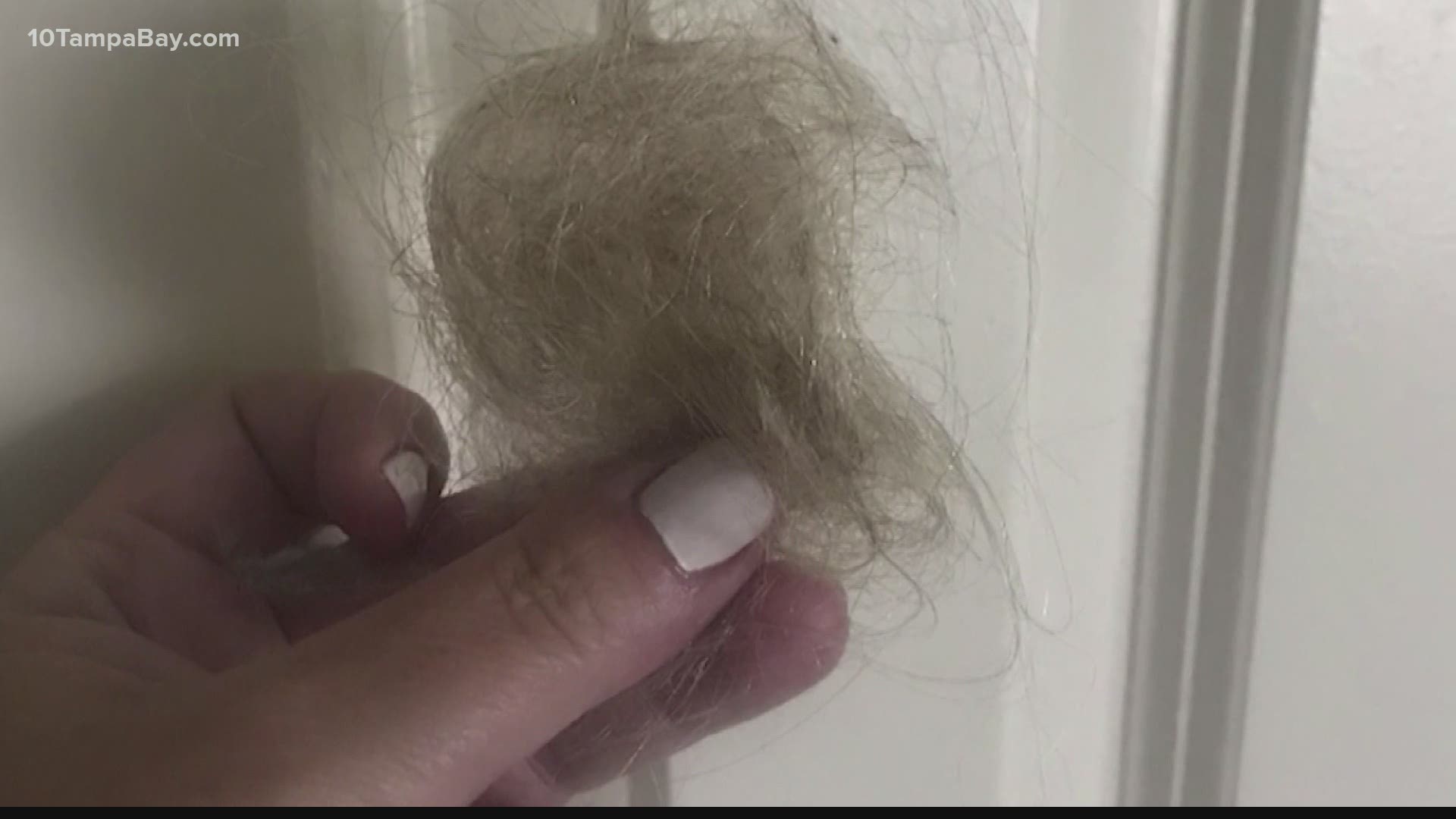 Some people dealing with hair loss months after having COVID-19 