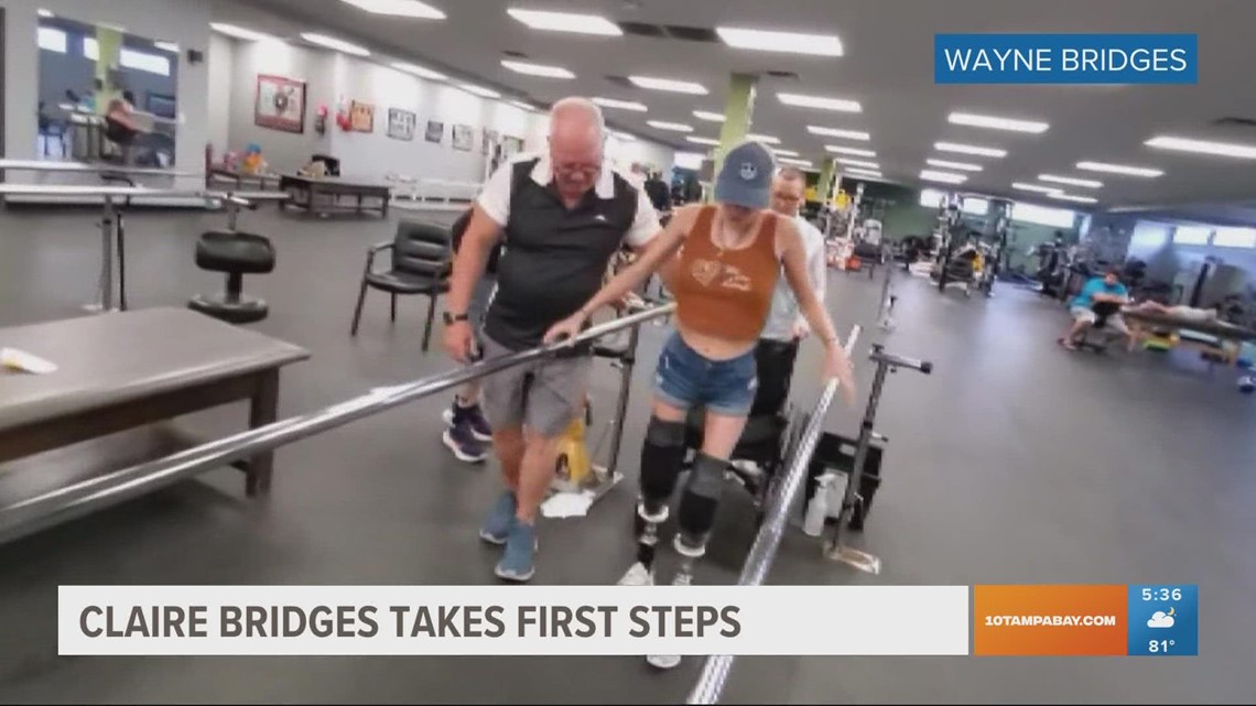St. Pete woman whose legs were amputated takes first steps - Vimarsana News