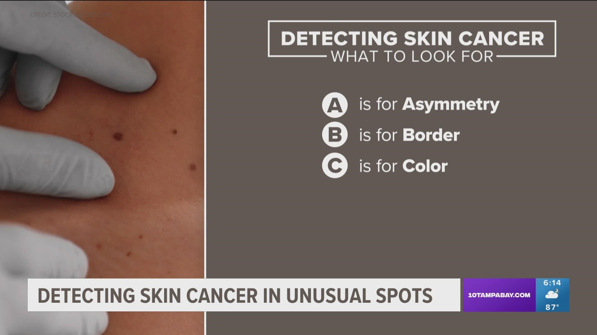 Florida ranks second in the nation for melanoma, the deadliest skin cancer.