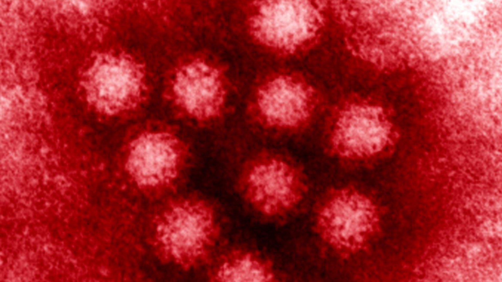 Roughly 50 educators were sickened by norovirus after a catered teacher appreciation luncheon on May 9 at Clark Elementary School in Tampa, health officials confirmed Thursday.

More than 100 staff members ate the food, which was provided by a local restaurant. Approximately half of them became sick afterward.

As of this week, authorities say they don't believe any students got ill. A school official said there is no outbreak on campus.