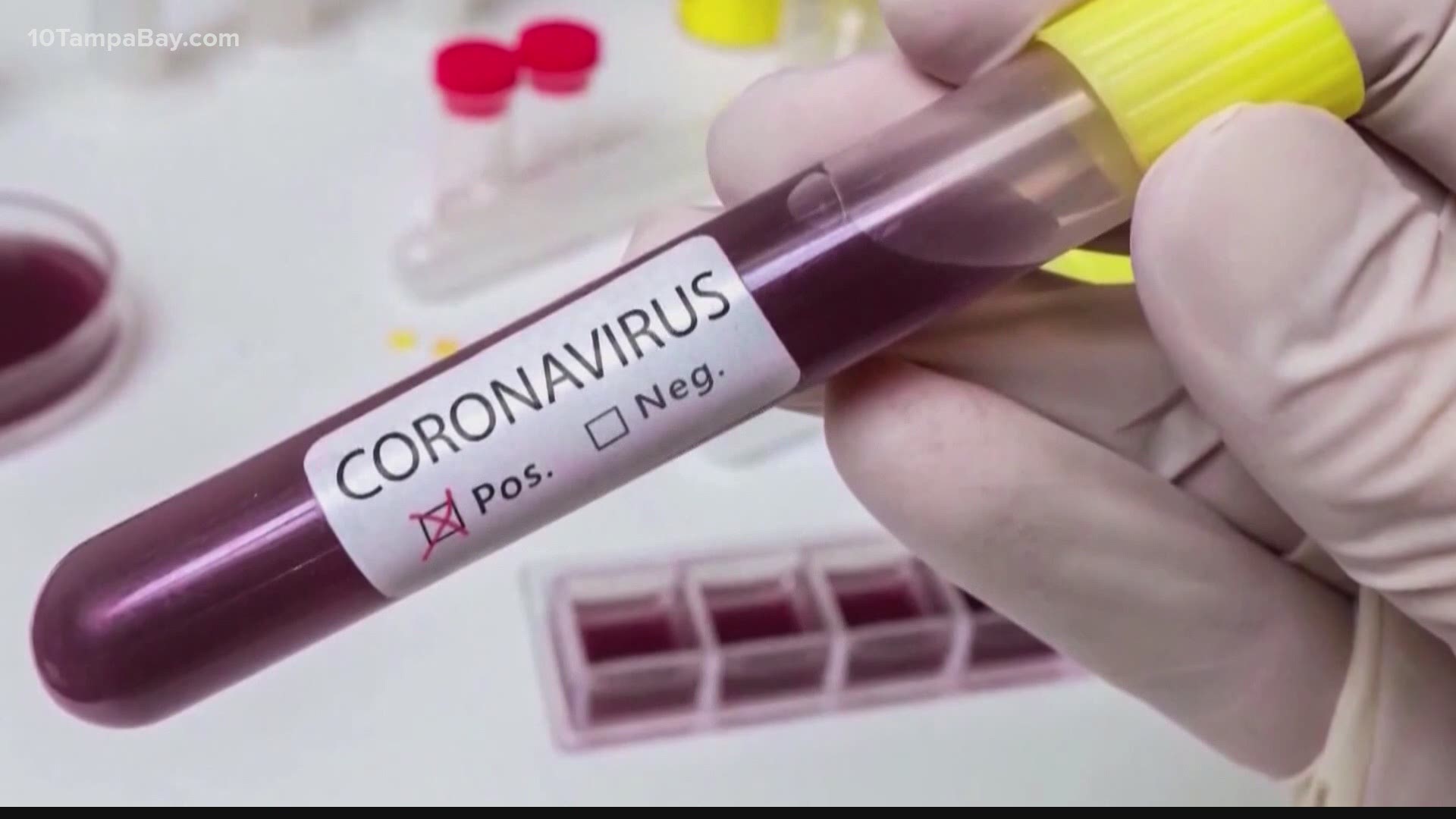 A new test being developed in USF's labs right now will help doctors treat COVID-19 patients.