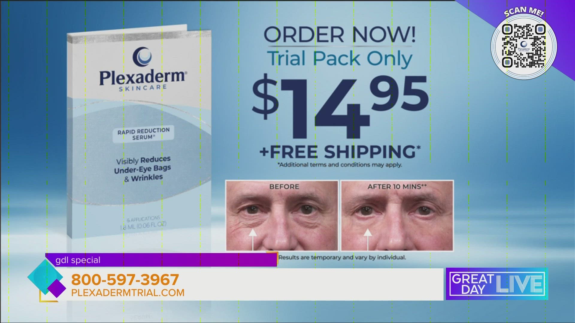 Paid segment sponsored by: Plexaderm. You can try Plexaderm for $14.95, plus free shipping. Just head to https://plxa.de/3lUdEW5
