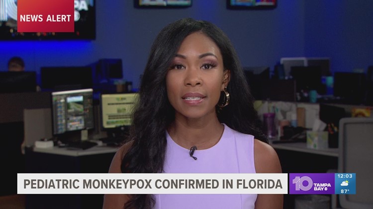 Florida reports 1st monkeypox case involving young child