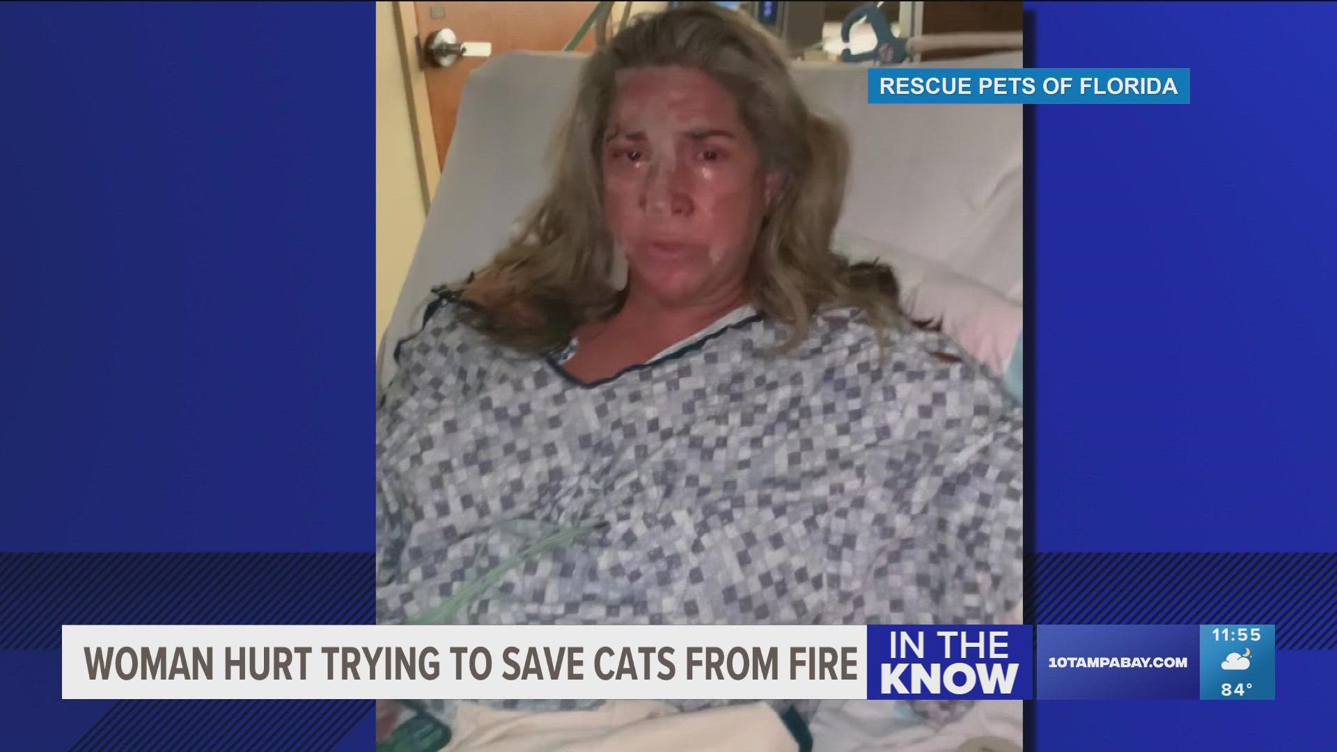 The woman is being treated for burns and respiratory issues, the Rescue Pets of Florida say