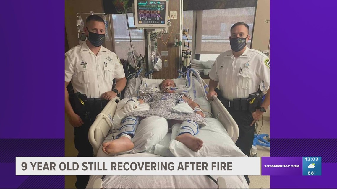 9yearold rescued from Seffner house fire showing signs of progress