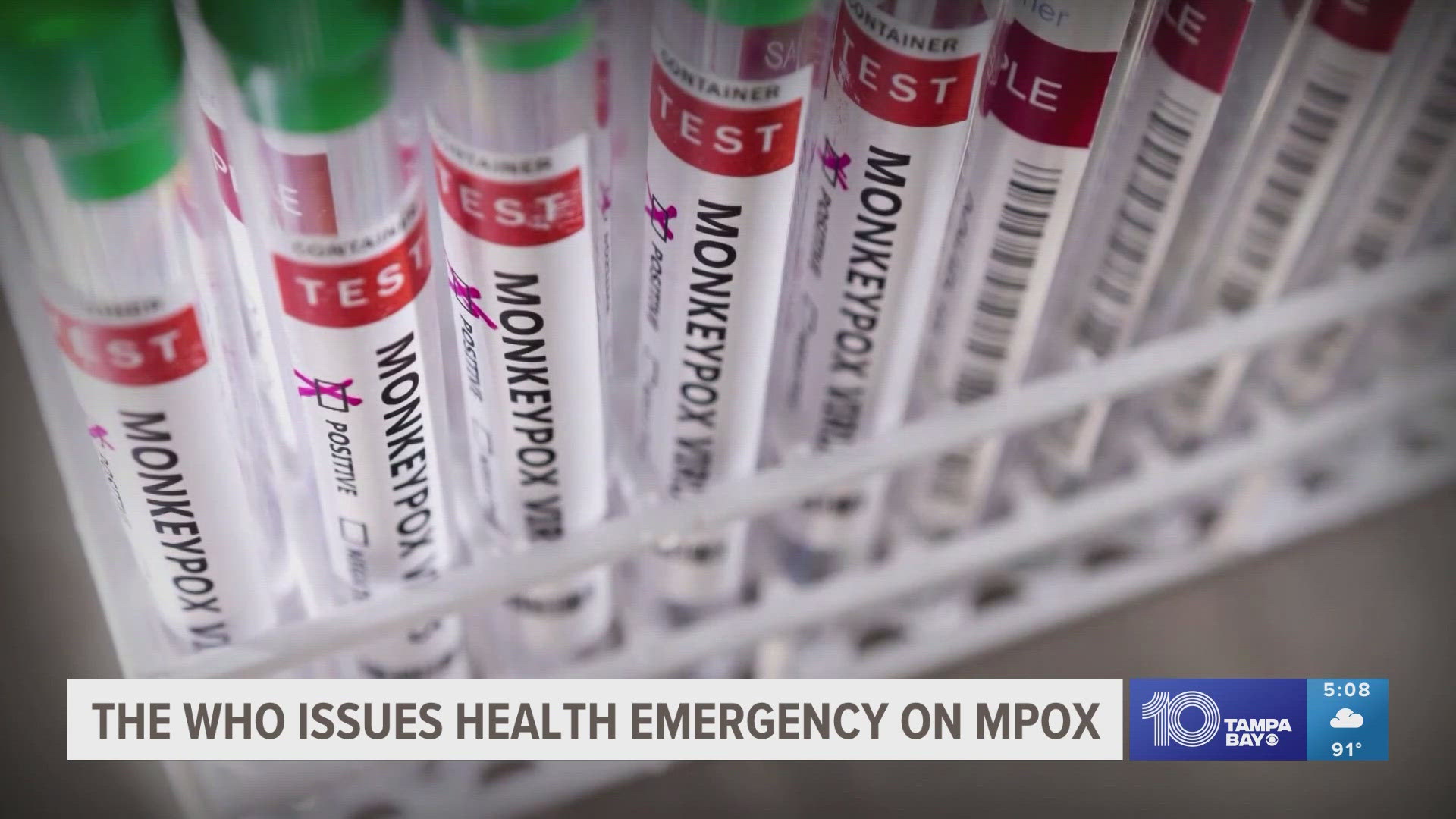 Earlier this week, the Africa CDC declared the mpox outbreaks a public health emergency, with more than 500 deaths among over 14,000 cases.