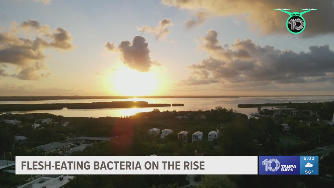 Flesheating bacteria cases on the rise in Florida; state officials monitoring after Helene