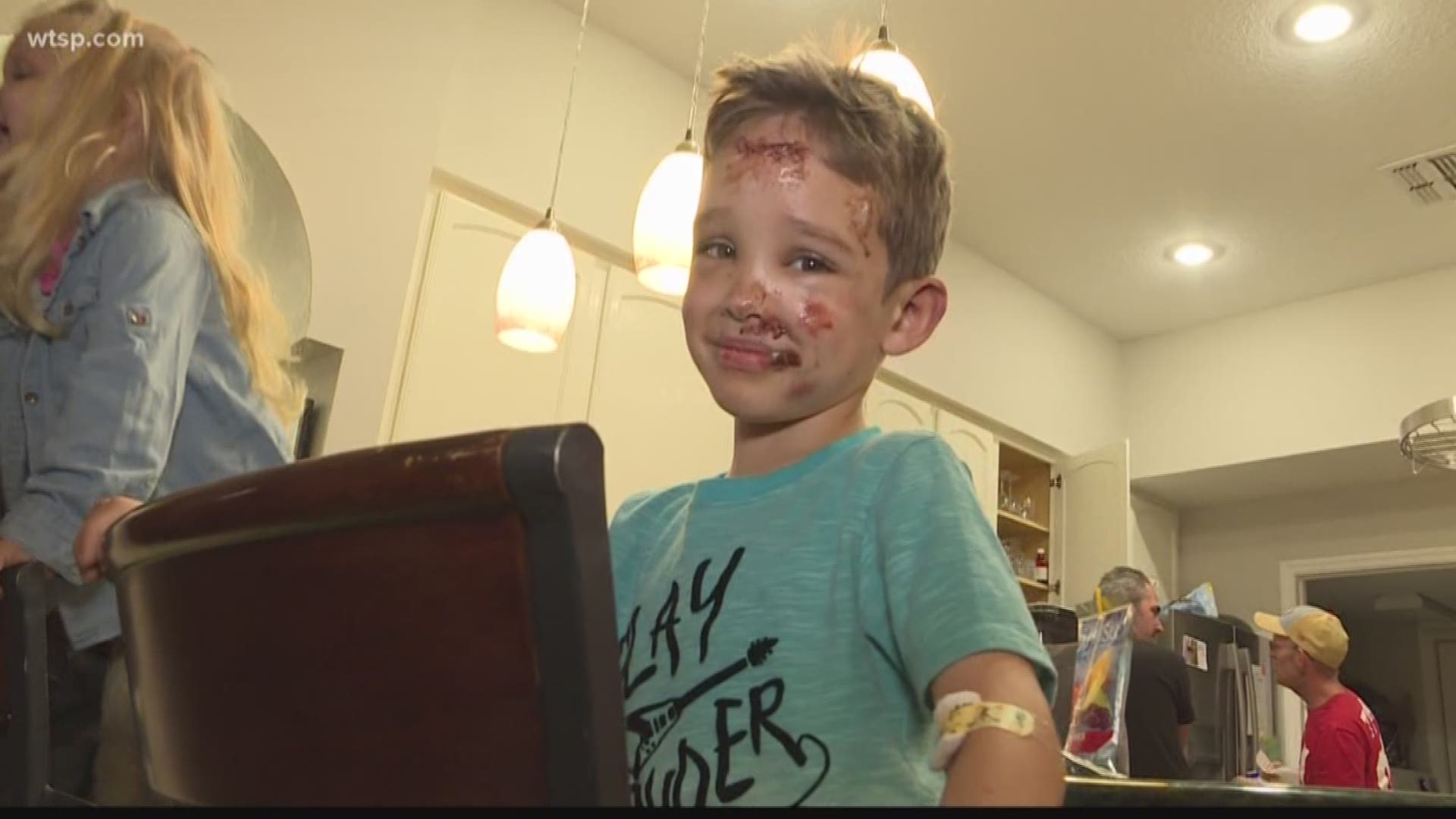 Dominick Keyes has a few bruises and stitches, but doctors said it will all heal with time.