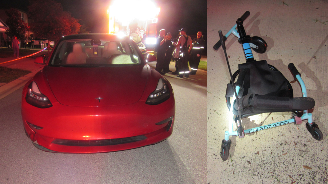 7-year-old hospitalized after getting hit by Tesla while riding seated scooter