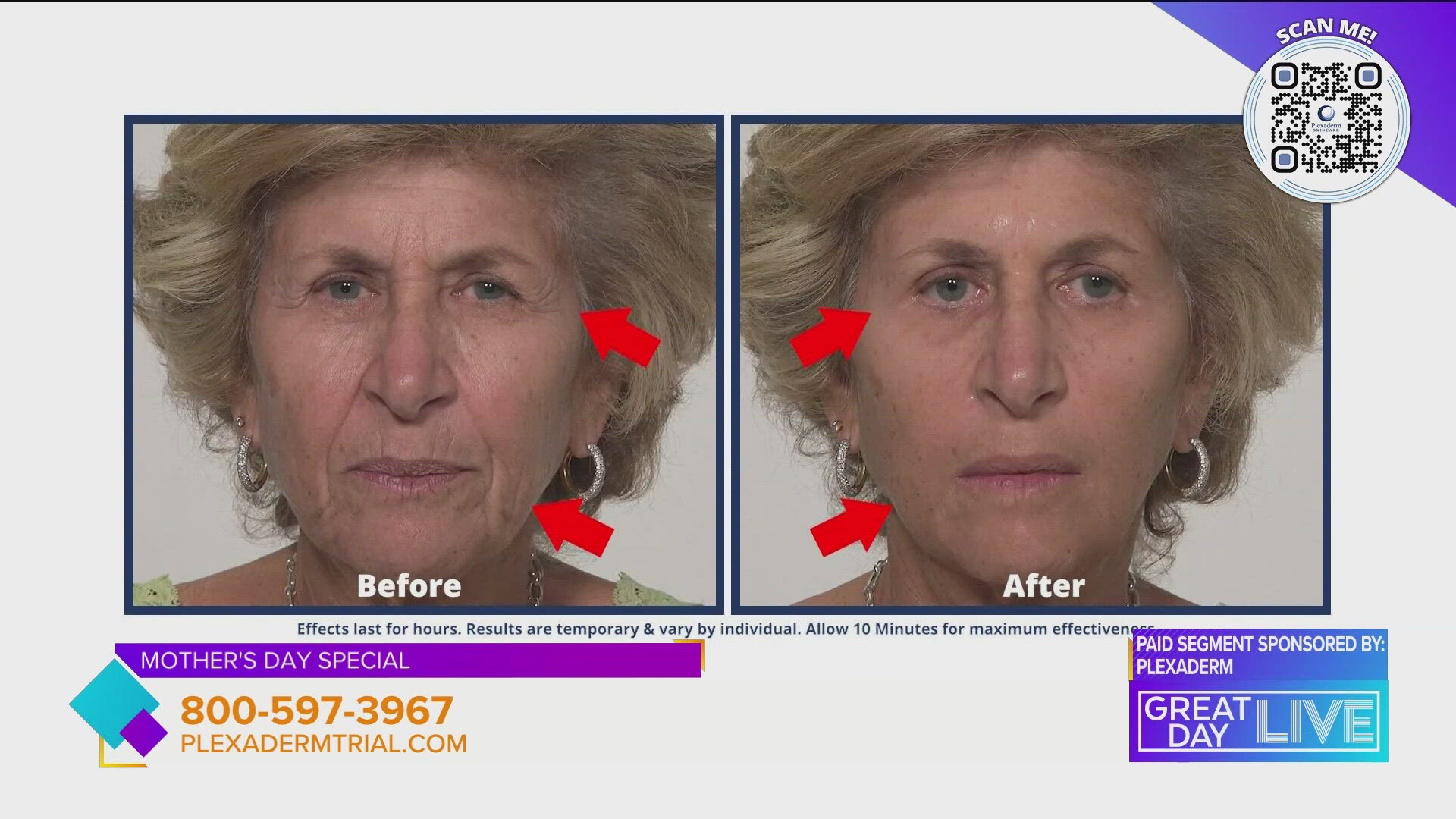 Take the Plexaderm 10-minute challenge. During this Mother's day special you will get to try Plexaderm for $14.95 plus free shipping. Head to  https://plxa.de/3lUdEW