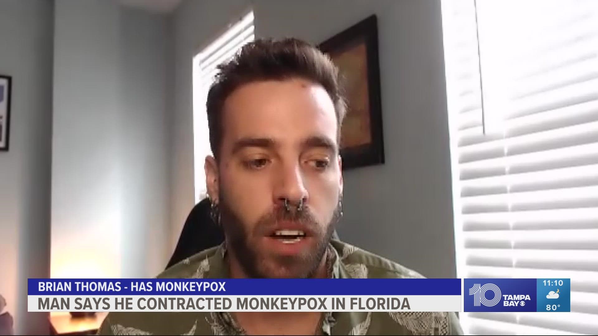 Brian Thomas, a nurse, tested positive for monkeypox after attending Ft. Lauderdale Pride. He is now using social media to spread awareness about the disease.
