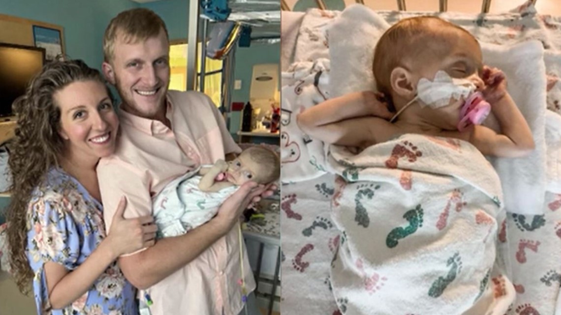 Florida baby fighting Wolman's disease only 13 others have - Vimarsana News
