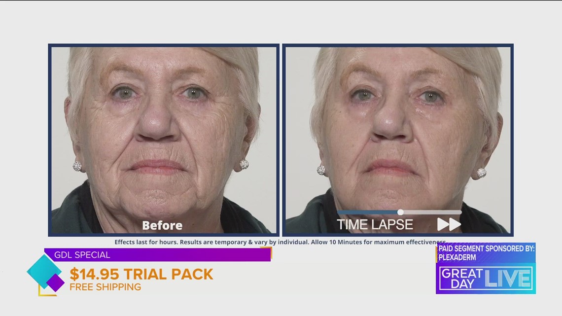 Erase the signs of aging before Spring is over | wtsp.com