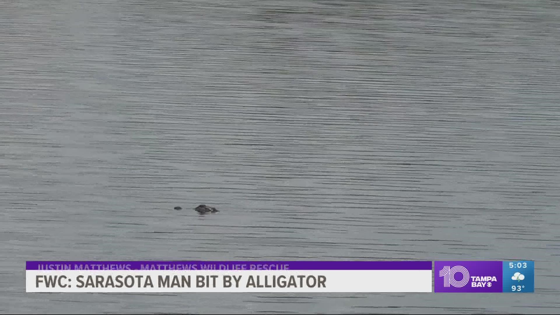 A man in Sarasota was seriously hurt when he was bitten by an alligator in Myakka City, FWC says.