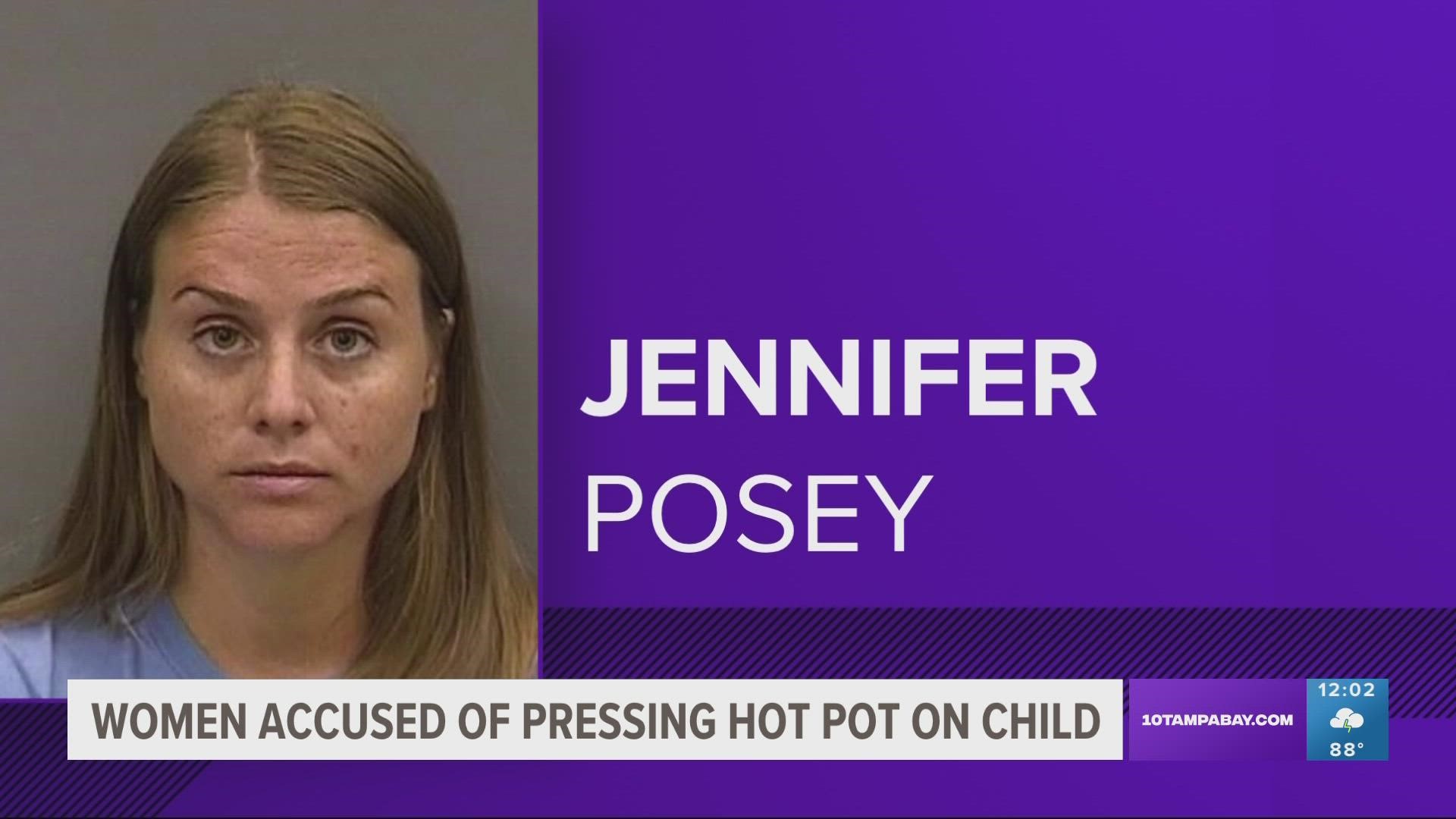 The child suffered a 4-inch burn, the Hillsborough County Sheriff's Office said in a statement.
