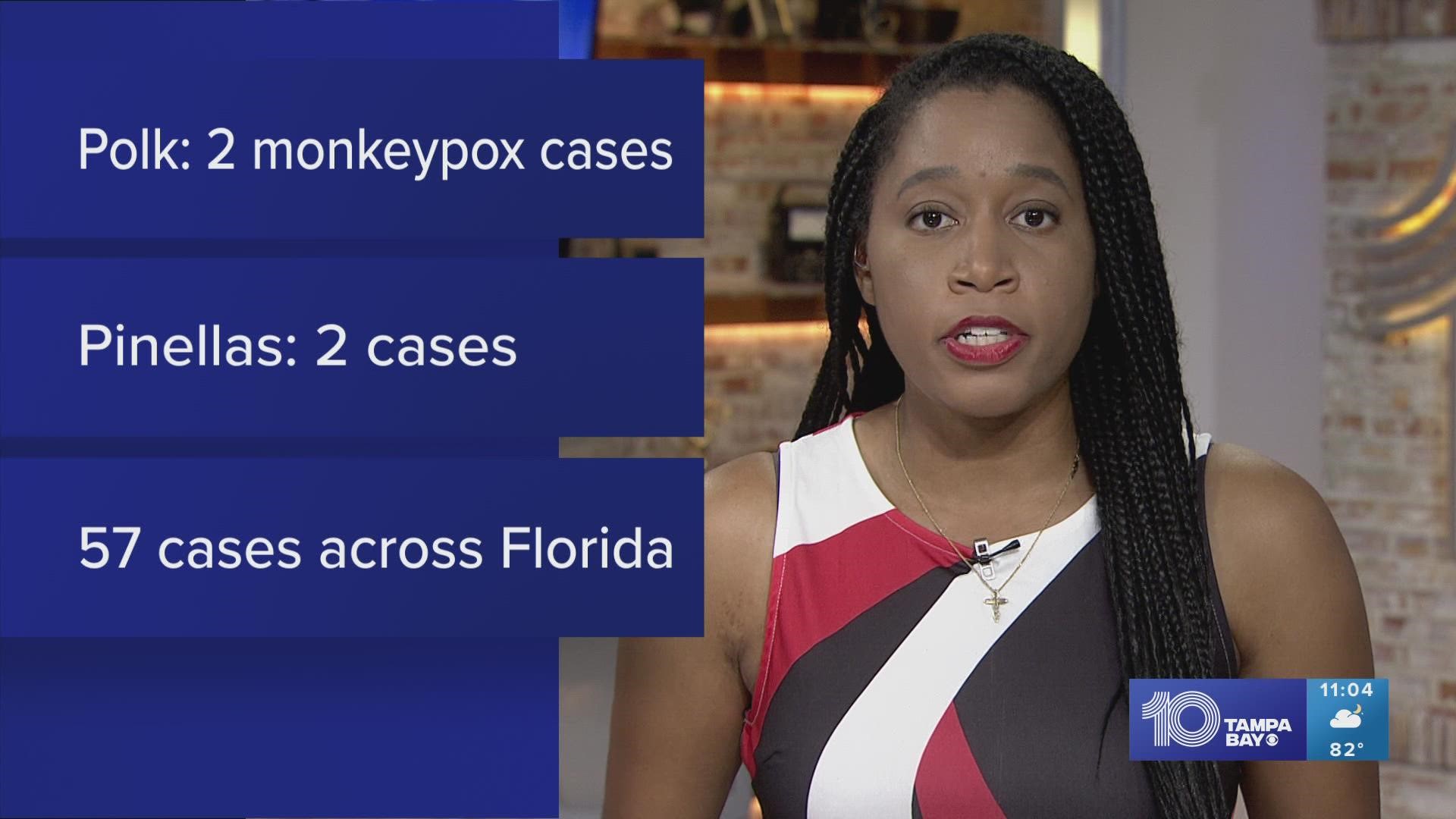 In Florida, there have been 57 cases of monkeypox, the state's department of health says.