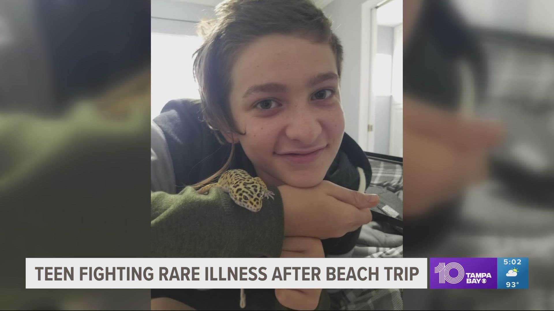 Caleb Ziegelbauer got sick after a trip to a Port Charlotte beach in July. Since then, he's been treated for a presumed amoeba infection in his brain.