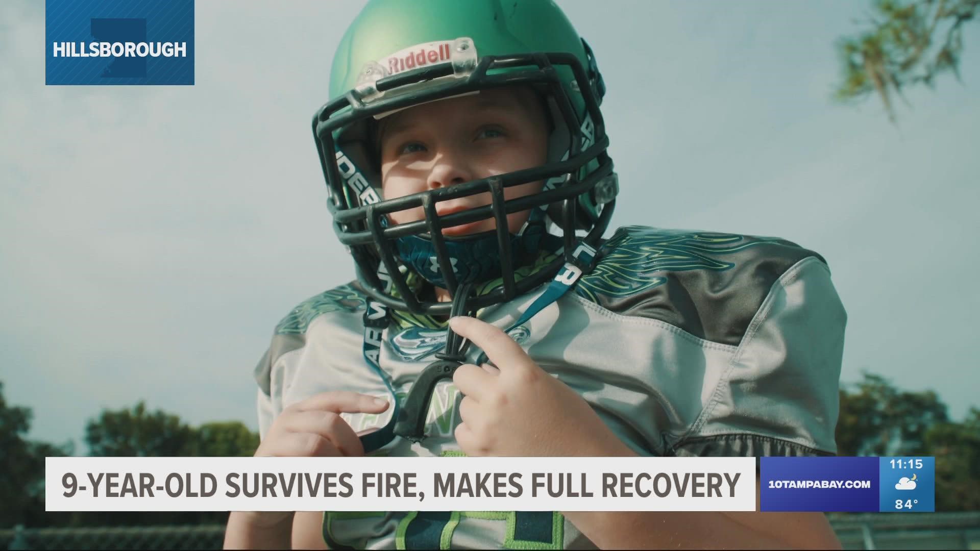 Owen Ares is able to play his favorite sport again after he was burned in a house fire back in May.