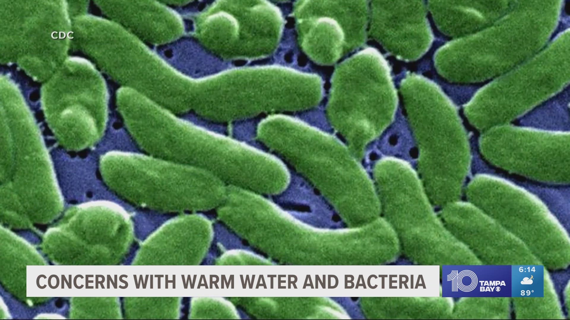 Among the rare bacteria that thrive in such conditions include Vibrio vulnificus.