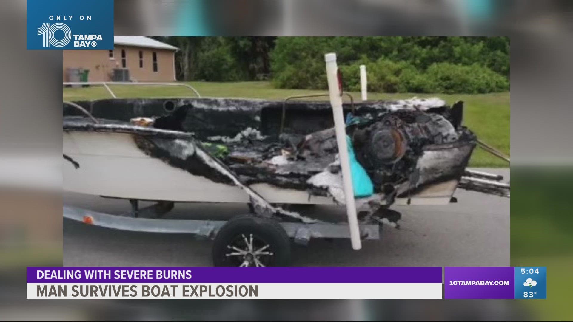 Florida man recovering after boat explosion sent him to ICU