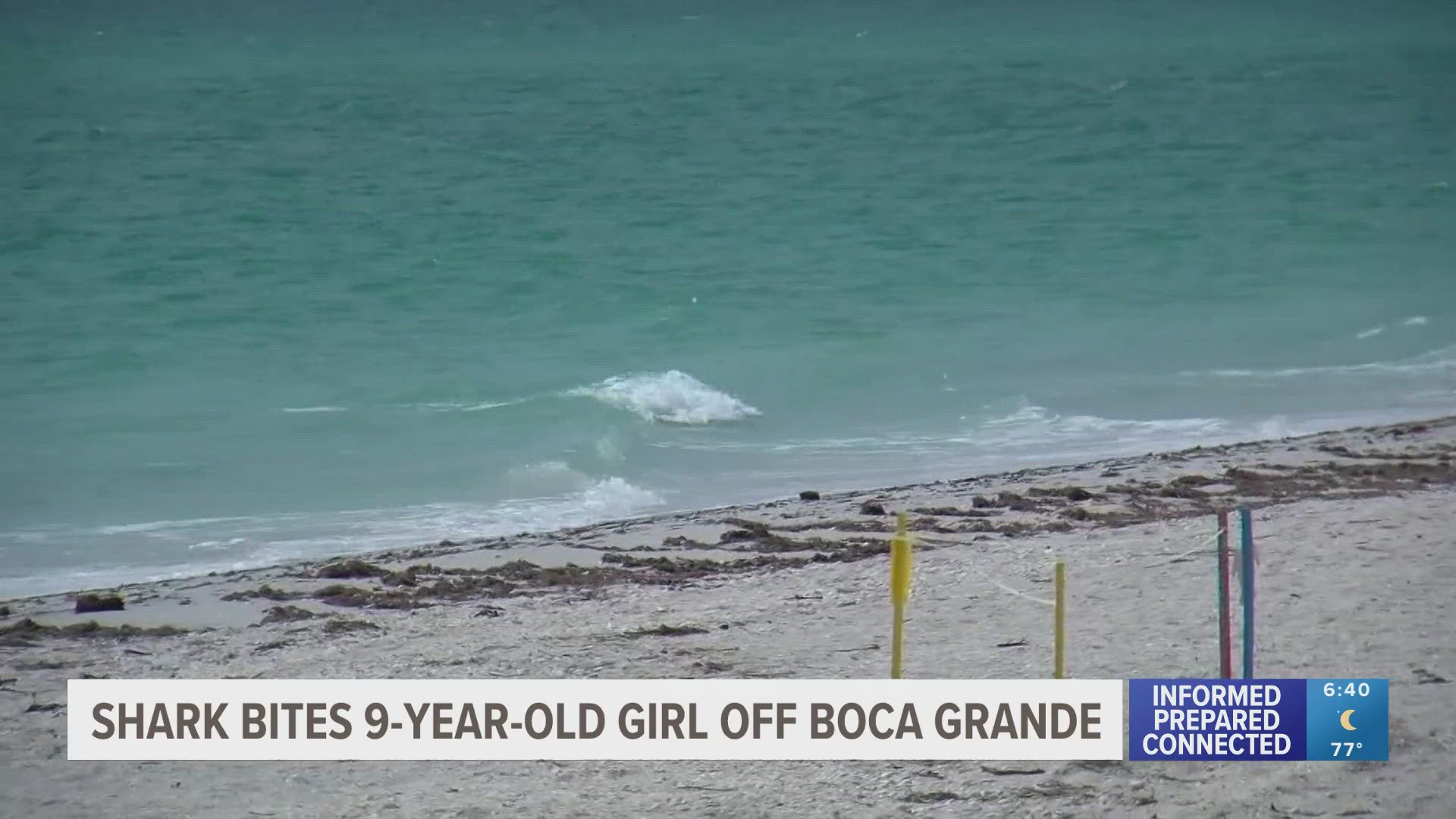The little girl is recovering after a long operation, according to her family. 