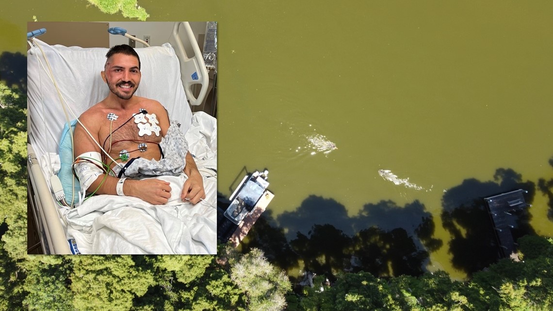 'In the jaws of a beast': Tampa Bay triathlete recovers and recounts attack by massive alligator