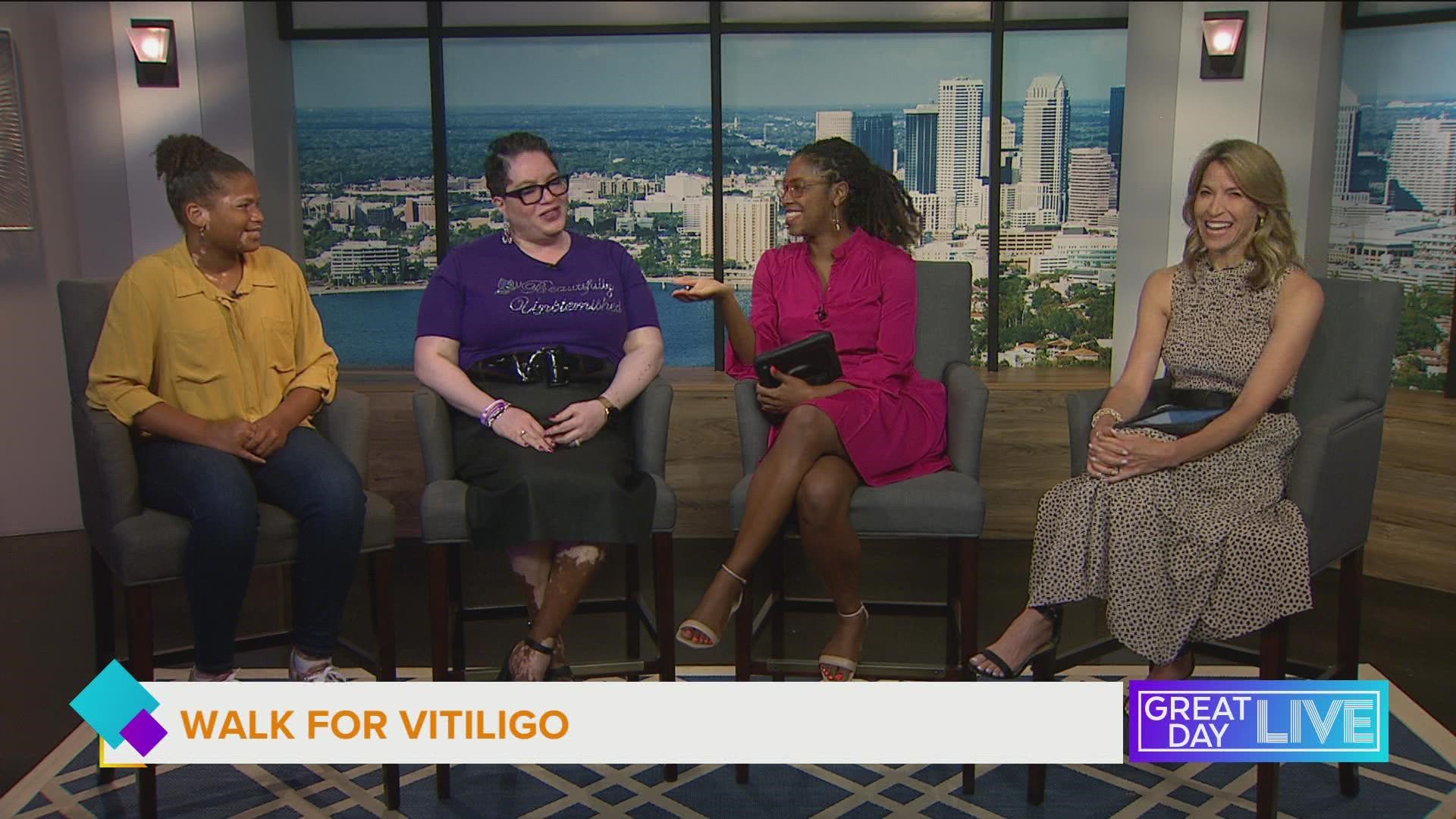 Walk for Vitiligo