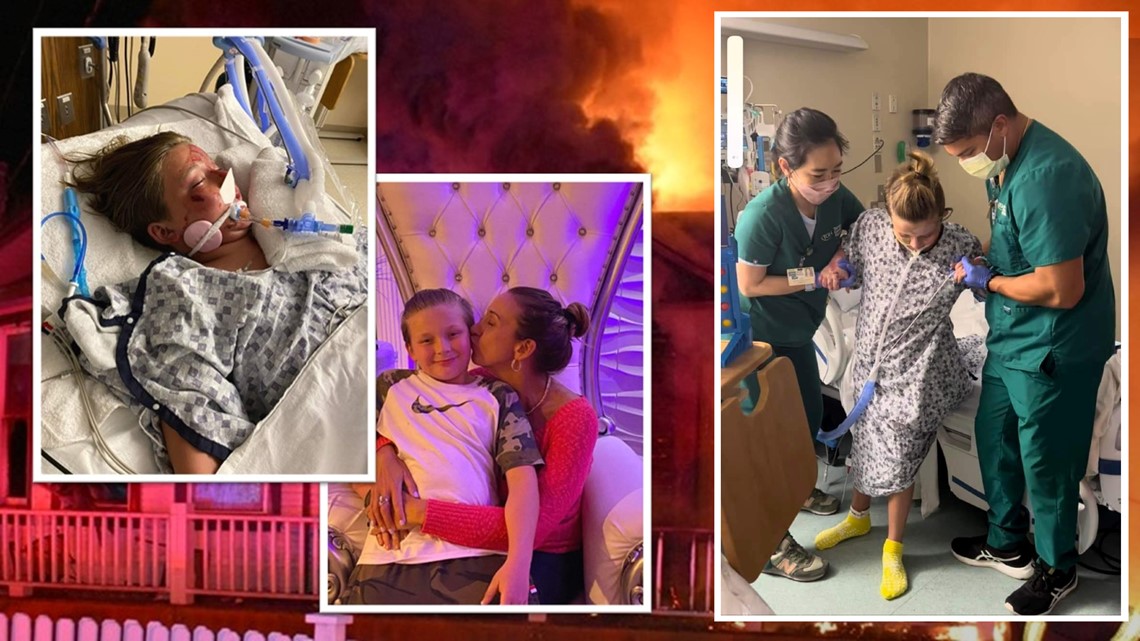 Boy rescued from Seffner house fire walks again for 1st time