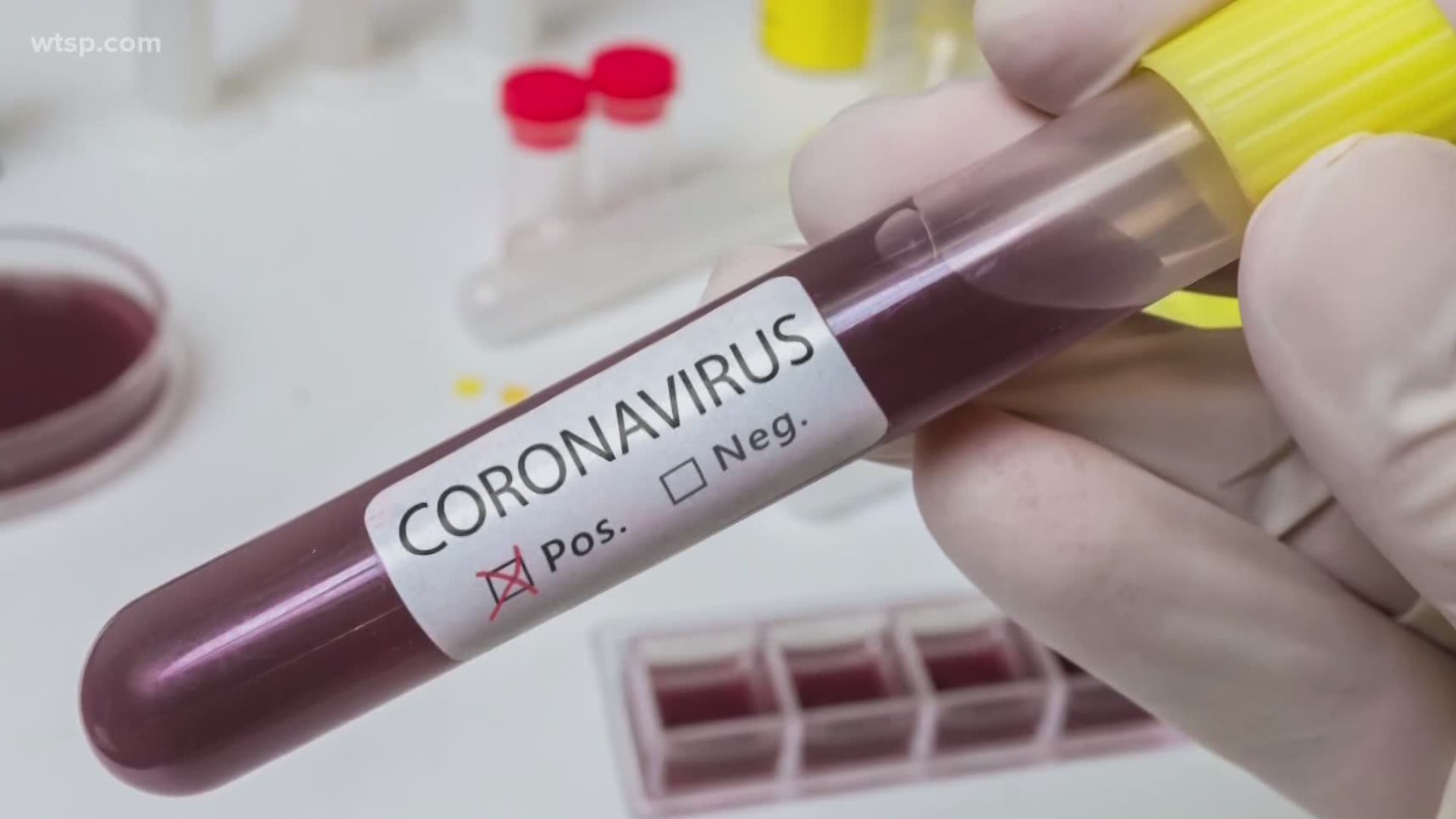 The state is now reporting a total of 200,111 confirmed coronavirus cases since the pandemic began.