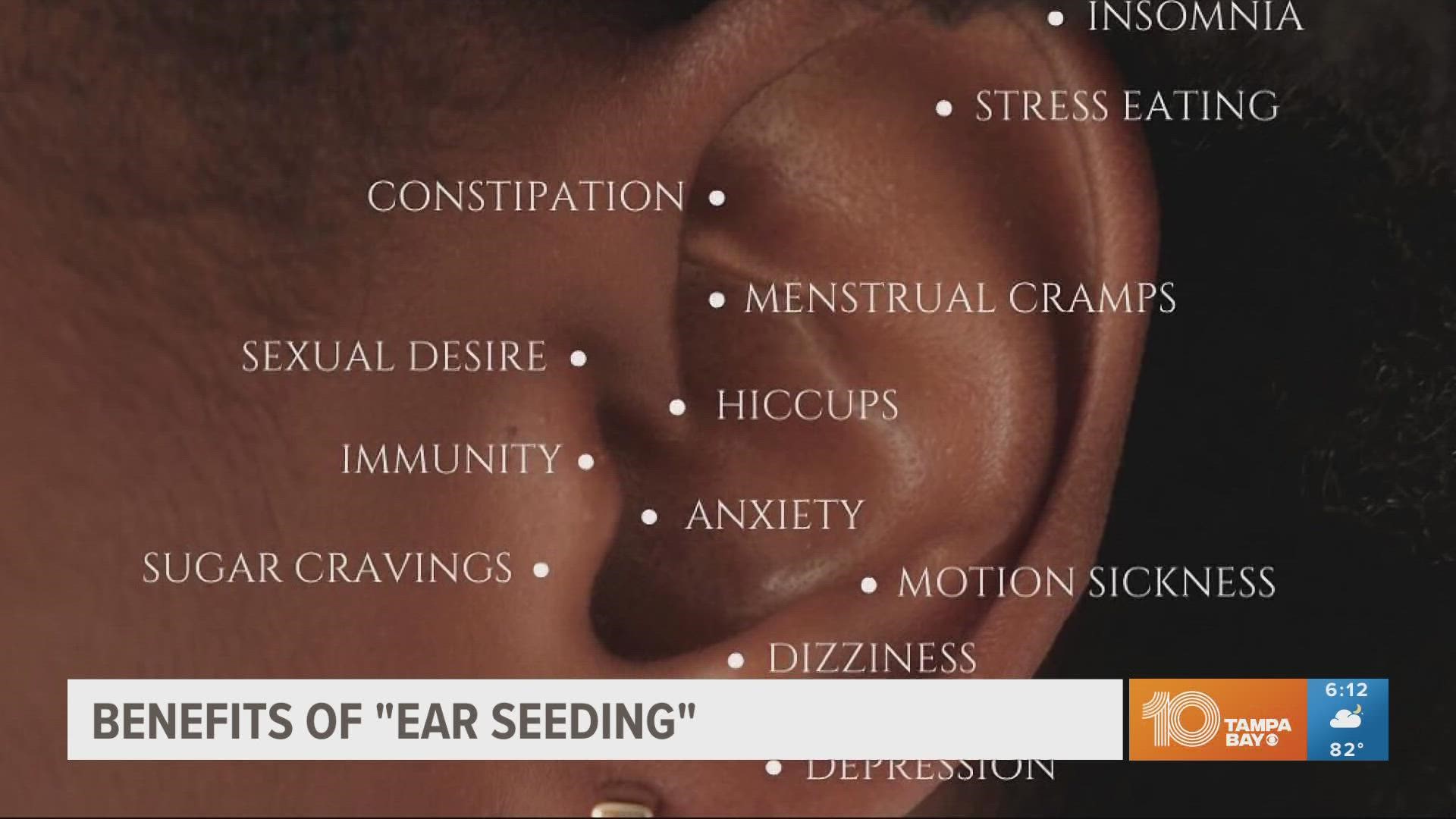 Ear seeding has been a part of traditional Chinese medicine for thousands of years.